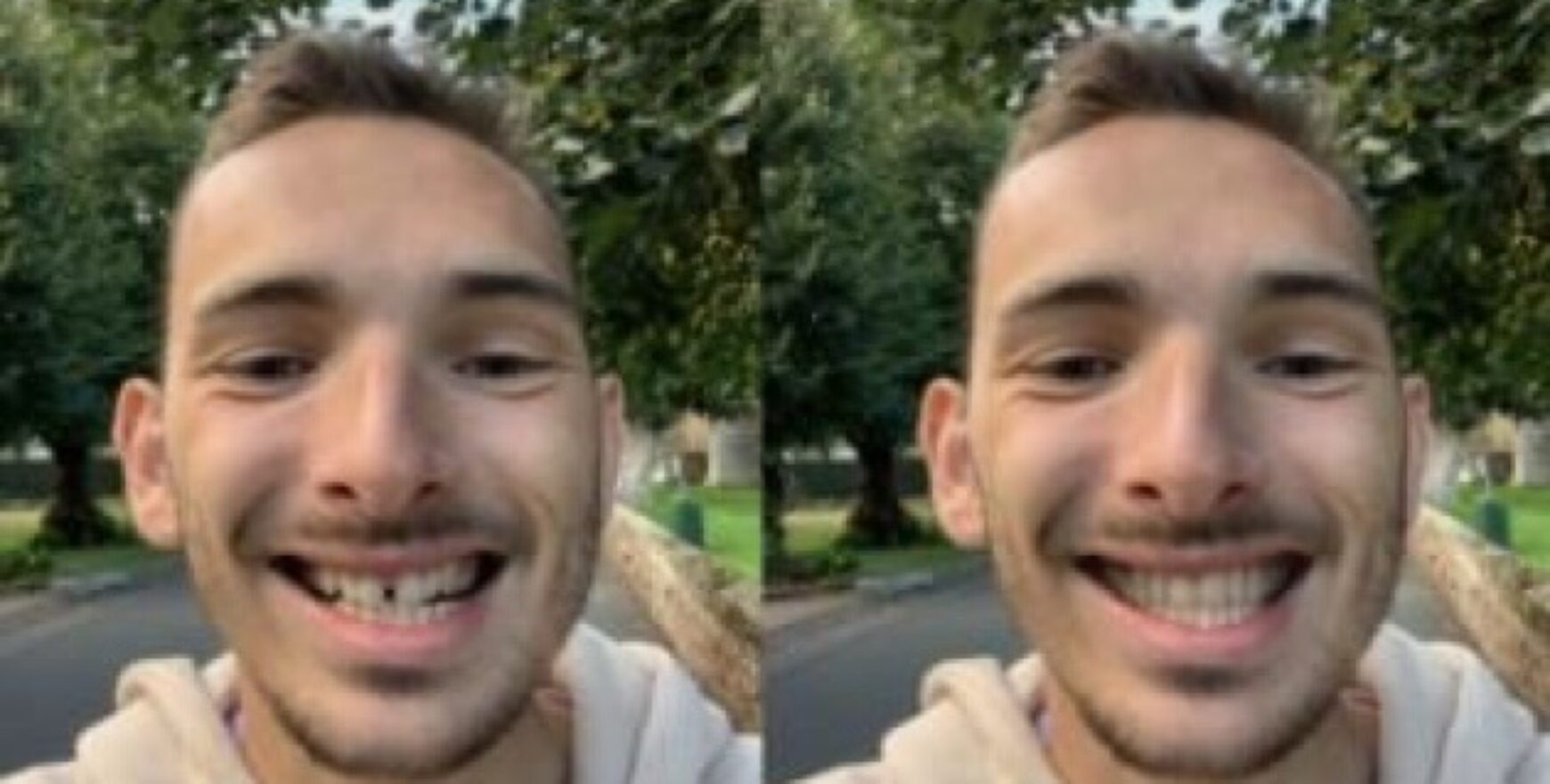 blog inner thumb : March Dental