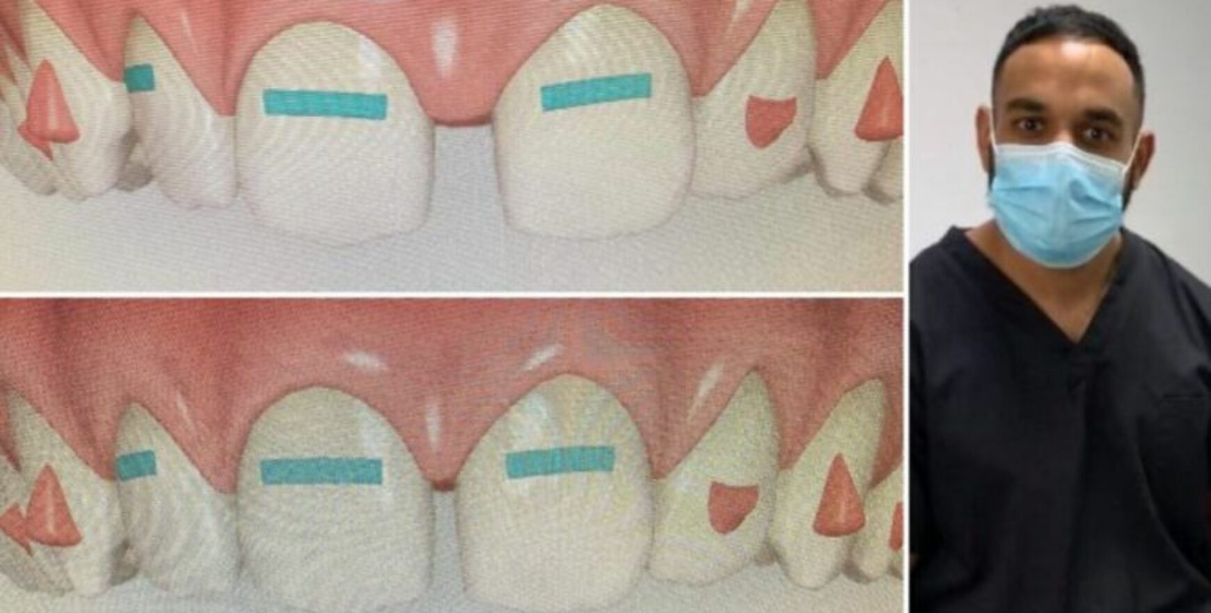 blog inner thumb : March Dental