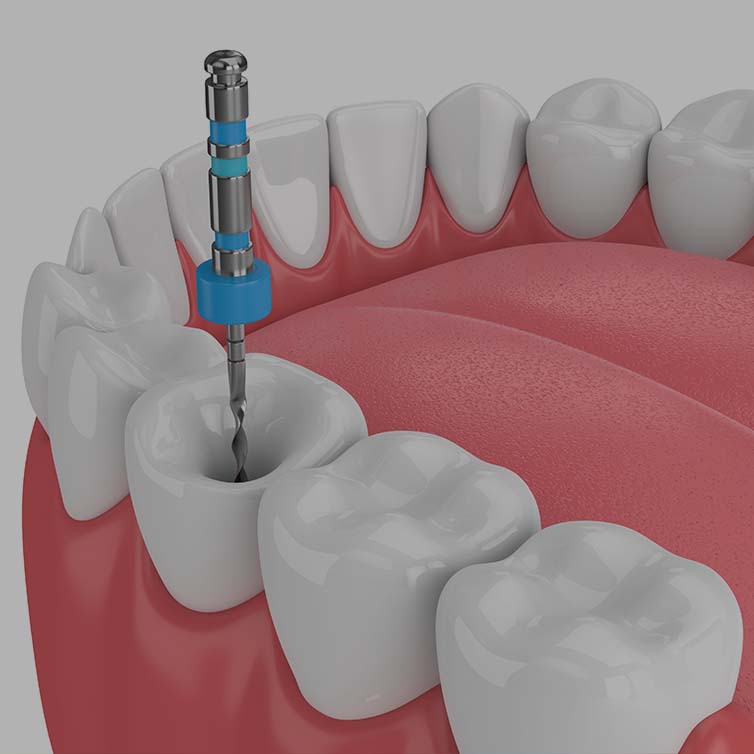 Treatment - March Dental